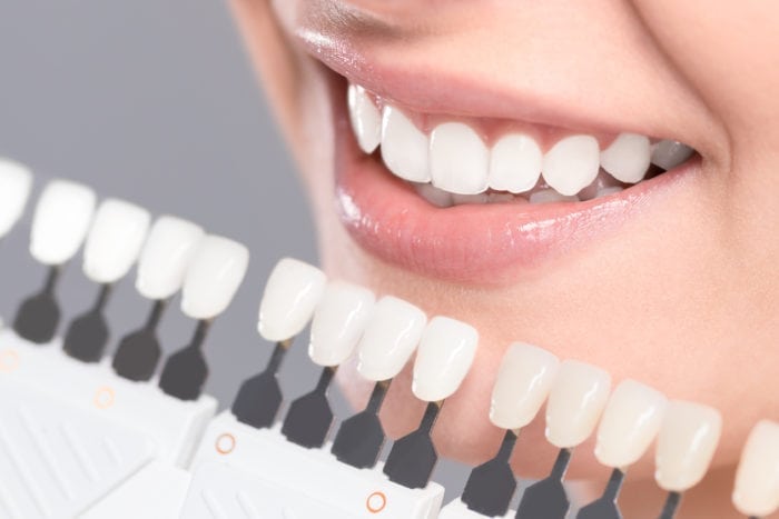 Teeth Whitening in Boise, ID