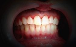 boise, idaho dentist