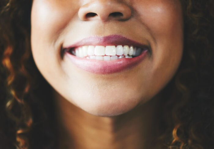 Dermal fillers offer a unique combination of benefits that can enhance your dental health while improving your appearance.